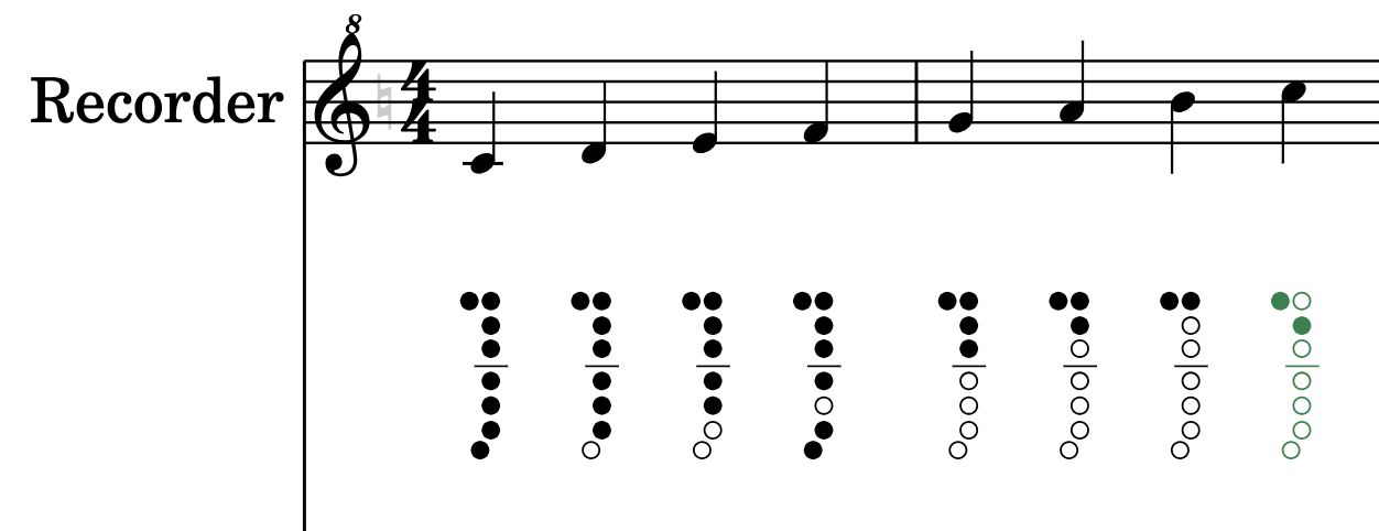 Soprano