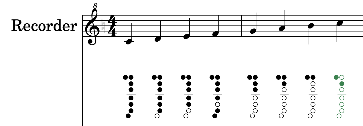 Soprano